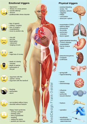 Grafikdesign Poster Broken Heart Syndrom, Stress Kardiomyopathie