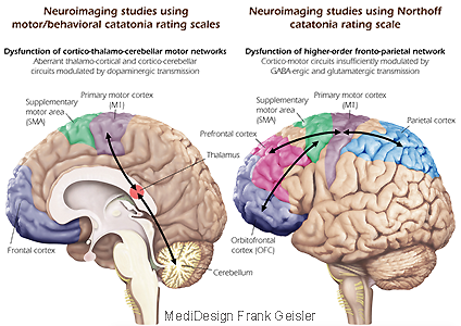 Grafikdesign Poster Neurologie Psychiatrie Katatonie Schizophrenie des Menschen