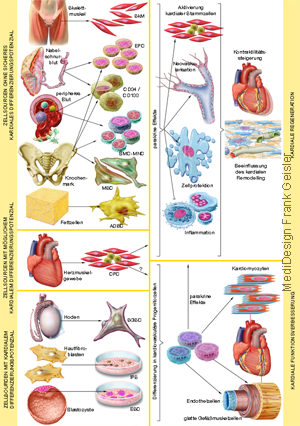 Grafikdesign Poster Herzerkrankung, Stammzellen Stammzellgewinnung in der Kardiologie