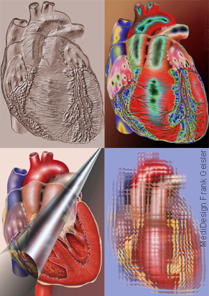 Medical Art Kardiologie, menschliches Herz von Frank Geisler