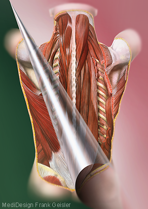 Medical Art Bild Rücken Muskeln Rückenmuskulatur