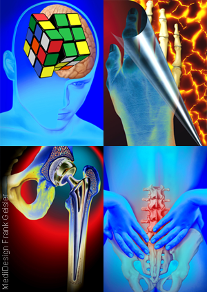 Medical Art Bilder Neurologie ZNS Schmerzen Orthopädie Arthrose von Frank Geisler